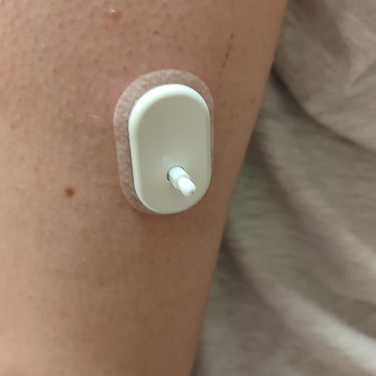 Sibionics CGM GS1 Cihazında Tekrarlayan Arıza Ve Yetersiz Müşteri Desteği