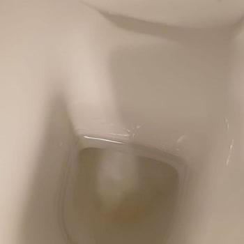 Vitra Klozetin Dip Kısmında Geçmeyen Sararma Ve Yetersiz Servis Desteği