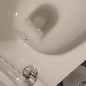 Vitra Klozetin Dip Kısmında Geçmeyen Sararma Ve Yetersiz Servis Desteği