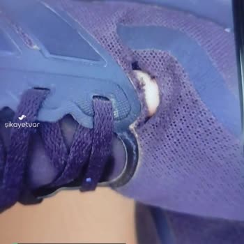 In Street Adidas Ayakkabı Yırtık
