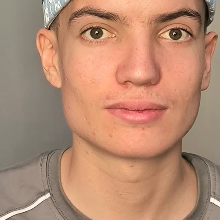 Ameliyat Sonrası Burun Yamukluğu Ve Nefes Alma Sorunum Çözülmedi