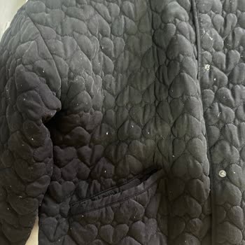 Zara Bomber Ceket Yıkama Sonrası Tüylendi Mağaza İlgisiz Kaldı