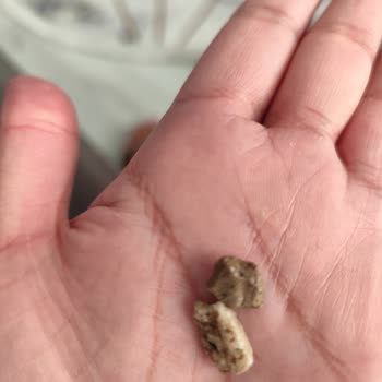 Aldığım Cipsin İçinden Taş Çıktı, Çocuğumun Sağlığı Tehlikeye Girdi