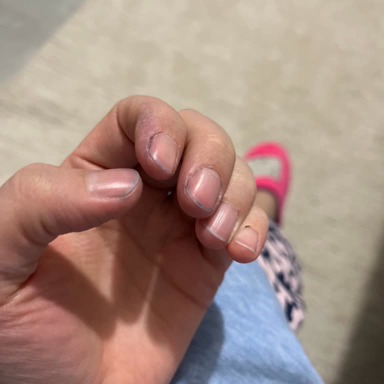 Her Kullanımda Boyası Çıkan Kazak Mağduriyeti