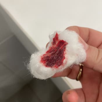 Manisa Şehir Hastanesi Kan Alma İşleminde Üstüm Başım Kan Oldu Ve Kolumda Morarma Meydana Geldi!