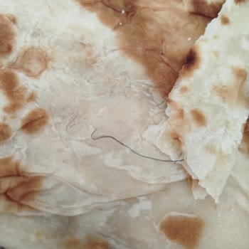 Satın Alınan Gözlemeden Kıl Çıkması Ve Hijyen Endişesi