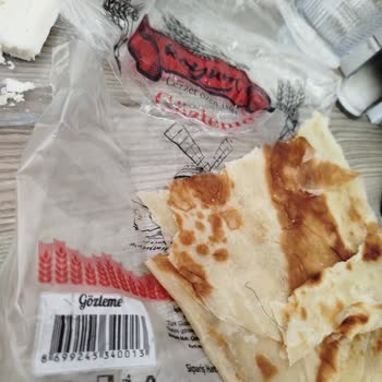 Satın Alınan Gözlemeden Kıl Çıkması Ve Hijyen Endişesi