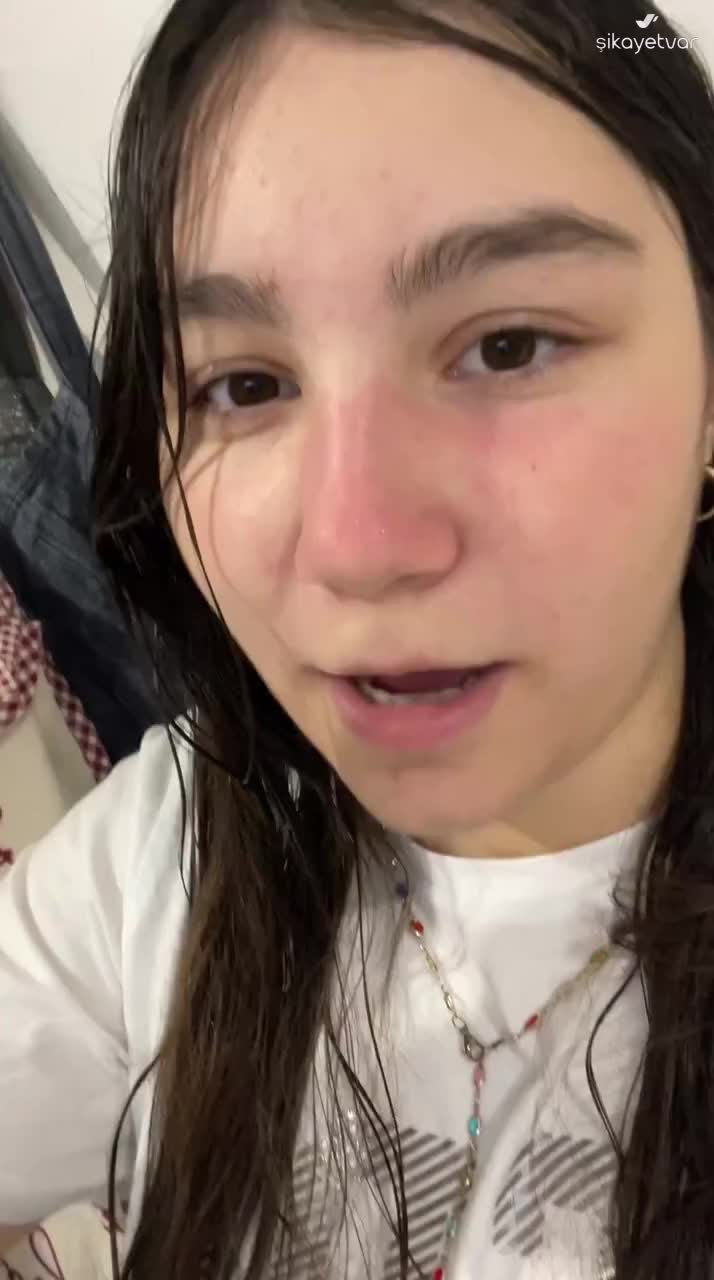 I Face Burning and Redness After Using Nivea Skin Clear Peeling Gel video cover
