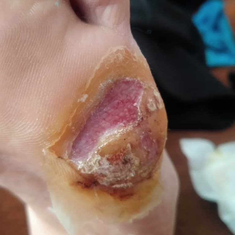 Yanlış Tıbbi Müdahale Sonrası Annemin Sağlığı Tehlikede