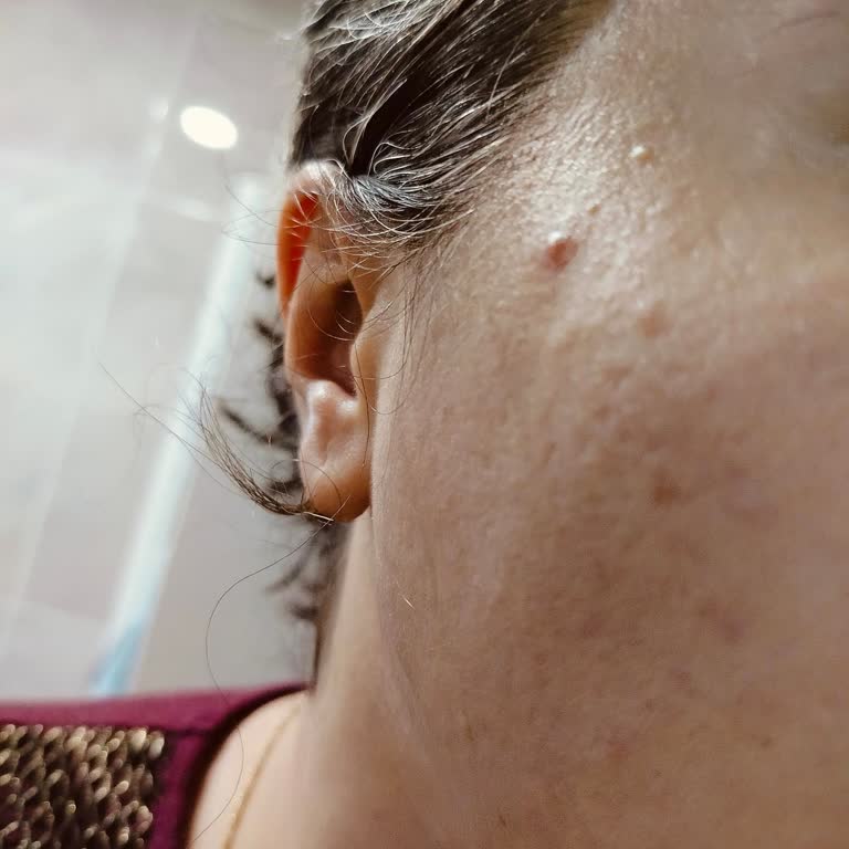 Yves Rocher Yüksek Fiyatlı Gece Kremi Cildimde Yoğun Sivilceye Neden Oldu, İade İstiyorum