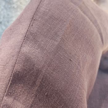 Yüksek Fiyatlı Etekte Kalite Kusuru Ve Müşteri Hizmetleri Sessizliği