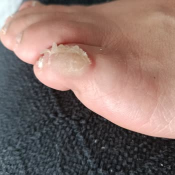 FLO'dan Aldığım Ayakkabı Ayağımda Sağlık Sorunu Oluşturdu, Değişim Talebim Reddedildi