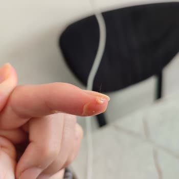 Tat Sriracha Mayonezde Kıl Çıkması Ve Hijyen Sorunu