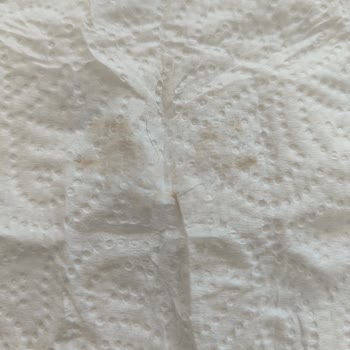 Tat Sriracha Mayonezde Kıl Çıkması Ve Hijyen Sorunu