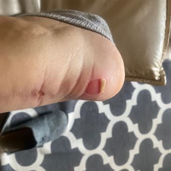 Satın Aldığım Converse Ayakkabıda Ergonomi Sorunu Ve Çözüm Bulunamaması