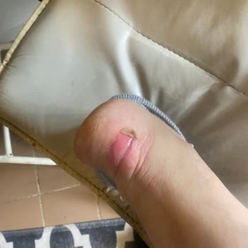 Satın Aldığım Converse Ayakkabıda Ergonomi Sorunu Ve Çözüm Bulunamaması