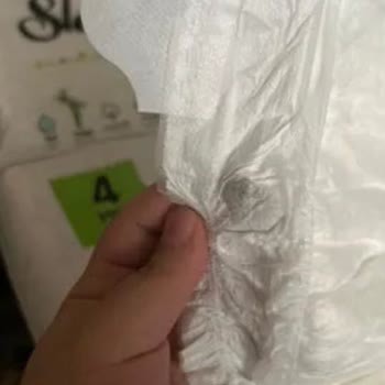 Sleepy Bio Naturel Bebek Bezinde Sürekli Ürün Hatası Ve Pişik Sorunu Mağduriyeti