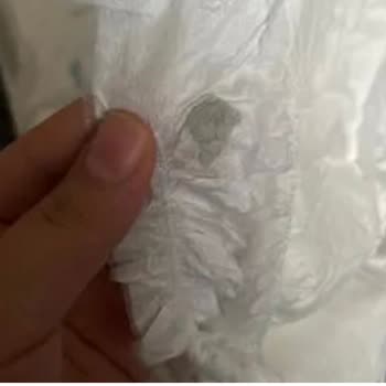 Sleepy Bio Naturel Bebek Bezinde Sürekli Ürün Hatası Ve Pişik Sorunu Mağduriyeti