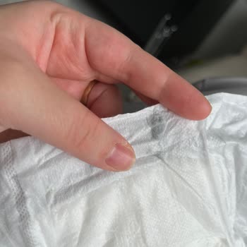 Sleepy Bio Naturel Bebek Bezinde Sürekli Ürün Hatası Ve Pişik Sorunu Mağduriyeti