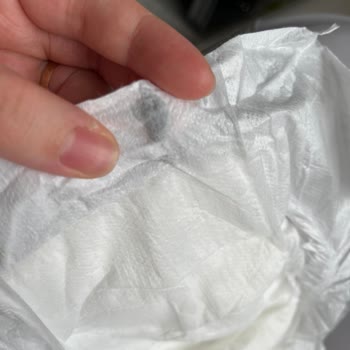 Sleepy Bio Naturel Bebek Bezinde Sürekli Ürün Hatası Ve Pişik Sorunu Mağduriyeti