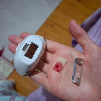 Sahte Ürün Satışı Ve İade Sorunu