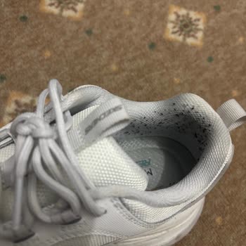 Kısa Sürede Deforme Olan Skechers Ayakkabı İçin İade Talebim Reddedildi