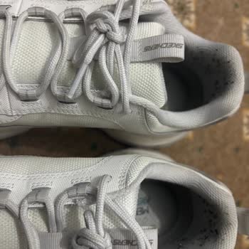 Kısa Sürede Deforme Olan Skechers Ayakkabı İçin İade Talebim Reddedildi