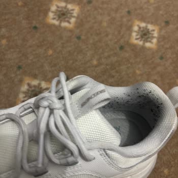 Kısa Sürede Deforme Olan Skechers Ayakkabı İçin İade Talebim Reddedildi