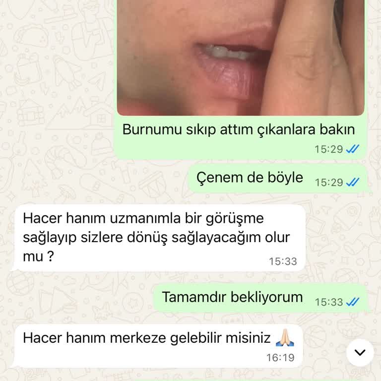 Yüz Temizliği Sonrası Vaat Edilen Sonuçlar Gerçekleşmedi Mağduriyet Yaşadım