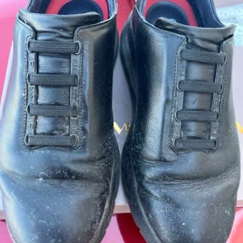 Kısa Sürede Deforme Olan Ayakkabıya Kullanıcı Hatası Denilmesi Mağdur Etti