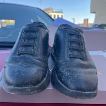 Kısa Sürede Deforme Olan Ayakkabıya Kullanıcı Hatası Denilmesi Mağdur Etti