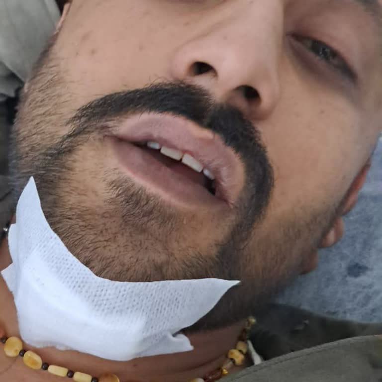 Acil Serviste Yetersiz Müdahale Sonucu Ciddi Yaralanma