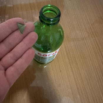 Soda Şişesinden Çıkan Cam Parçası Oğlumun Sağlığını Tehlikeye Attı