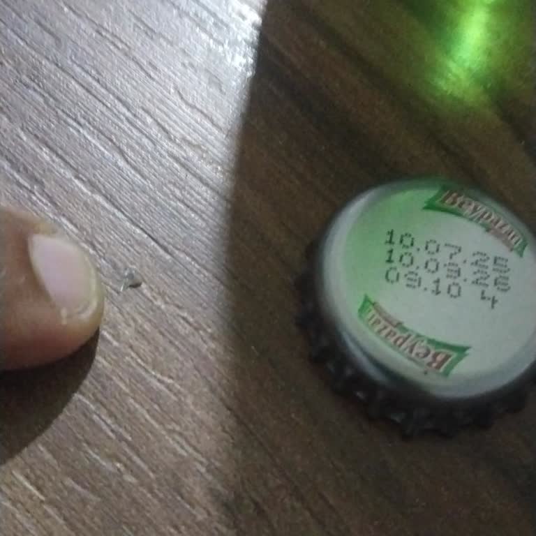 Soda Şişesinden Çıkan Cam Parçası Dişimi Yaraladı, Güvenlik Endişesi Yaşıyorum