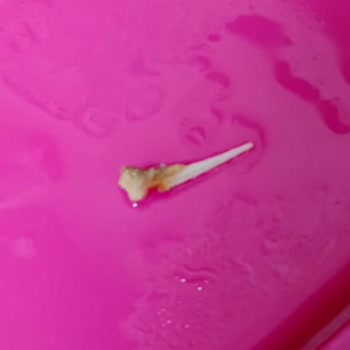 Superfresh Ton Balığında Kılçık Ve Pul Sorunu: Aynı Şubede Tekrarlayan Kalite Problemi