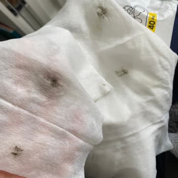 Sleepy Yeni Doğan Islak Havluda Lekeler Bebeğimin Sağlığı Risk Altında Mı