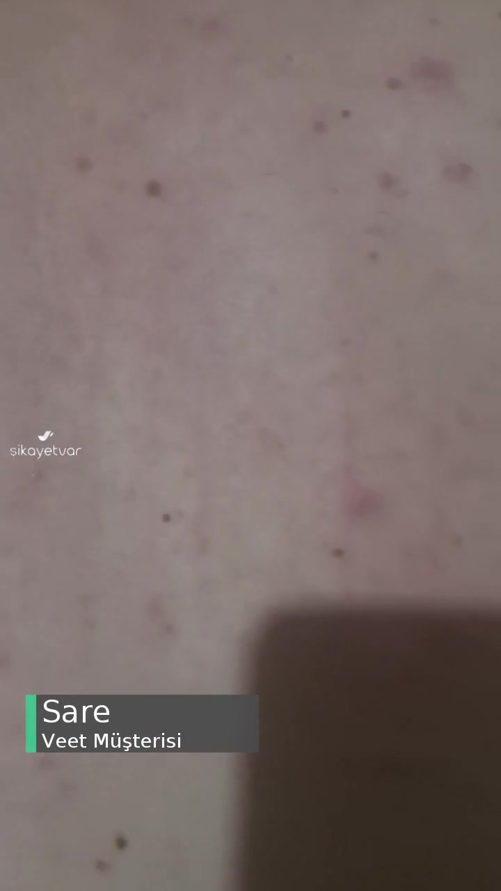 Veet Tüy Dökücü Krem Alerji Yaptı! videonun kapak resmi