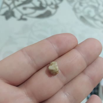 Simbat Soslu Mısırdan Taş Çıktı Sağlığım Tehlikeye Girdi