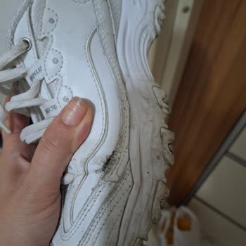 Skechers D'Lites Ayakkabıda Kısa Sürede Dikiş Patlaması Ve Kalite Sorunu