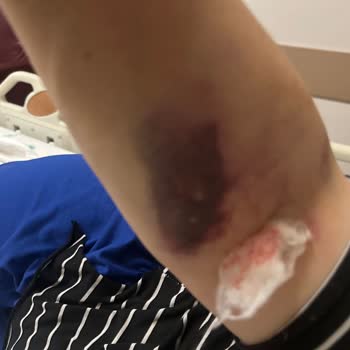 Acil Serviste İhmalkarlık Ve Şiddet Mağduriyeti