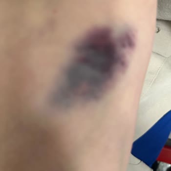 Acil Serviste İhmalkarlık Ve Şiddet Mağduriyeti