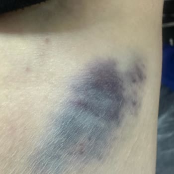 Acil Serviste İhmalkarlık Ve Şiddet Mağduriyeti