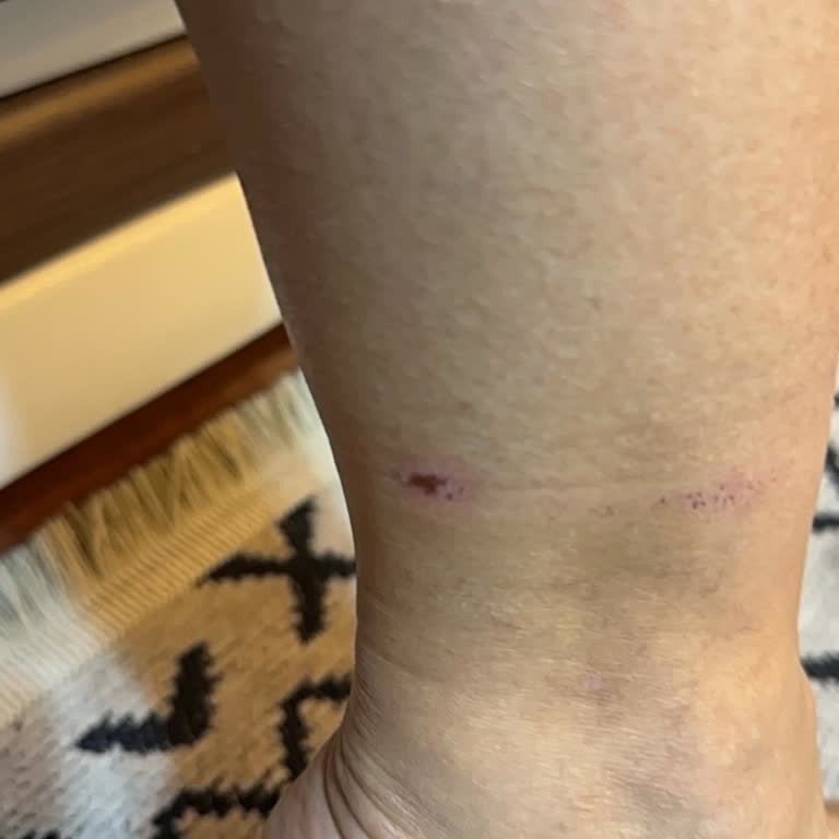 Kısa Sürede Hasar Gören Ürün İçin Değişim Talebinin Reddedilmesi