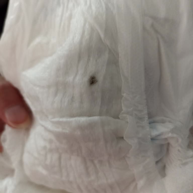 Molfix 3 Numara Bebek Bezinde Yapışkan Madde Sorunu Ve Çözüm Talebi