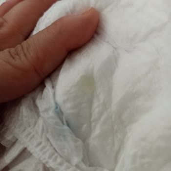 Molfix 3 Numara Bebek Bezinde Yapışkan Madde Sorunu Ve Çözüm Talebi