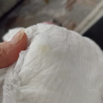 Molfix 3 Numara Bebek Bezinde Yapışkan Madde Sorunu Ve Çözüm Talebi