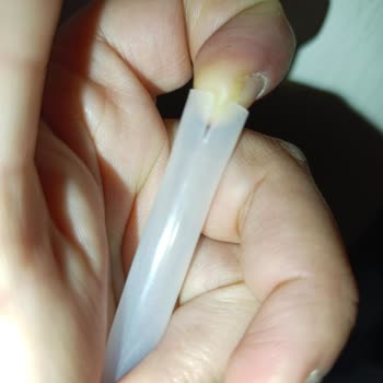 Aldığım Ürünler Sürekli Hasarlı Geliyor, İade Ve Çözüm Sunulmuyor