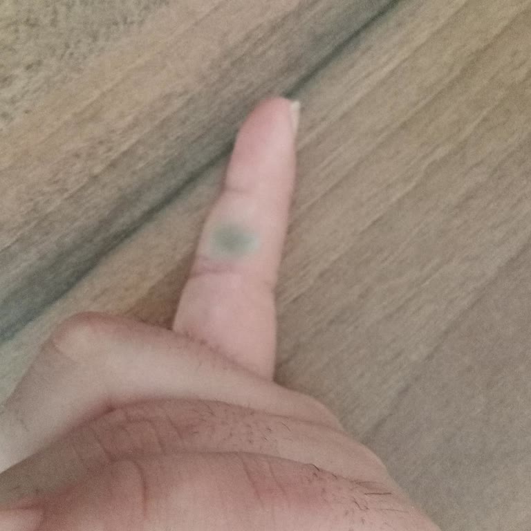 Hastanede Yetersiz İlgi Ve Yönlendirme Nedeniyle Yaşanan Mağduriyet