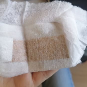 Bebek Mendilinde Yabancı Cisim Ve Hijyen Skandalı!