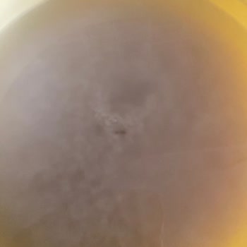 Aldığım Pirincin İçinden Kurt Çıktı, Mağazaya Taşımak Mağduriyet Yarattı